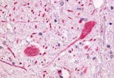 Immunohistochemistry-Paraffin: GPR55 Antibody - BSA Free [NLS6817]