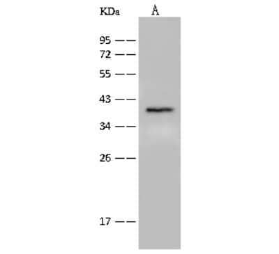 Western Blot: GPR55 Antibody [NBP2-99403]