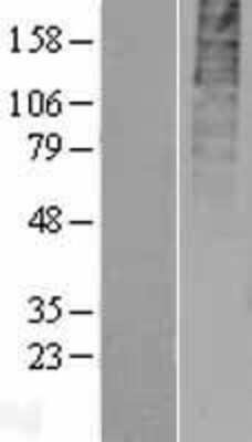 Western Blot: GPR55 Overexpression Lysate [NBL1-11284]