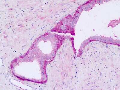 Immunohistochemistry-Paraffin: GPR56 Antibody - BSA Free [NLS4027]