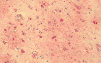 Immunohistochemistry-Paraffin: GPR56 Antibody - BSA Free [NLS8182]