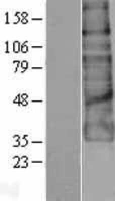 Western Blot: GPR56 Overexpression Lysate [NBP2-04297]