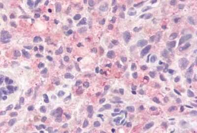 Immunohistochemistry-Paraffin: GPR78 Antibody - BSA Free [NLS3278]