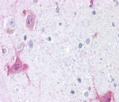 Immunohistochemistry: GPR6 Antibody [NBP3-14361]