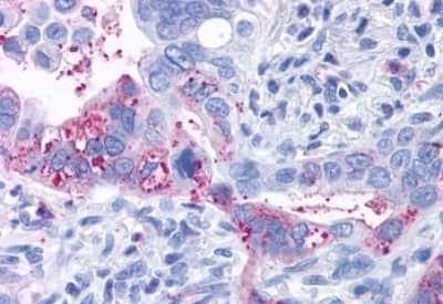 Immunohistochemistry-Paraffin: GPR6 Antibody [NBP3-14361]