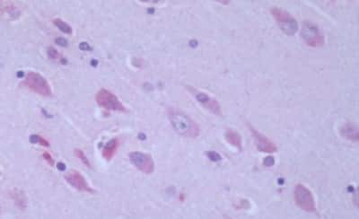 Immunohistochemistry-Paraffin: GPR6 Antibody [NBP3-14361]