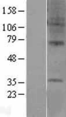 Western Blot: GPR6 Overexpression Lysate [NBL1-11286]