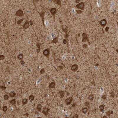 Immunohistochemistry: GPR61 Antibody [NBP1-88716]