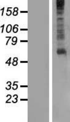 Western Blot: GPR61 Overexpression Lysate [NBL1-11287]