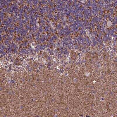 Immunohistochemistry: GPR63 Antibody [NBP1-82362]