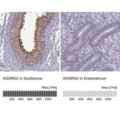 Immunohistochemistry-Paraffin: GPR64 Antibody [NBP1-84906]