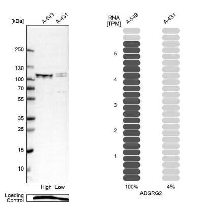 Western Blot: GPR64 Antibody [NBP2-55504]