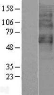 Western Blot: TDAG8/GPR65 Overexpression Lysate [NBP2-04251]