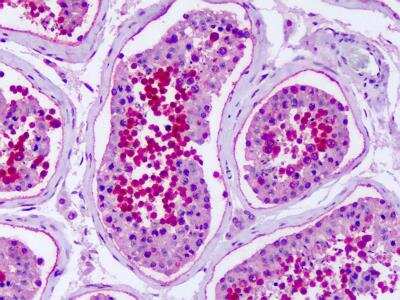 Immunohistochemistry-Paraffin: GPR75 Antibody - BSA Free [NBP2-31114]