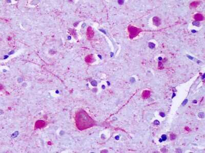 Immunohistochemistry-Paraffin: GPR75 Antibody - BSA Free [NLS1593]