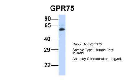 Western Blot: GPR75 Antibody [NBP1-59406]