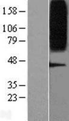 Western Blot: GPR75 Overexpression Lysate [NBL1-11291]