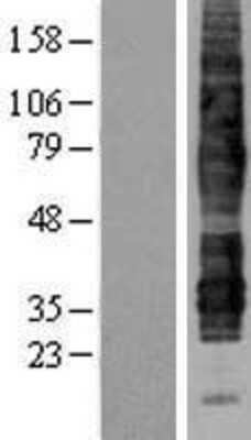 Western Blot: C5L2/GPR77 Overexpression Lysate [NBL1-11292]