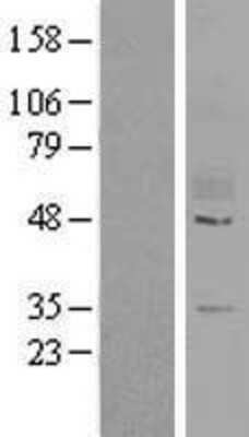 Western Blot: GPR78 Overexpression Lysate [NBL1-11293]