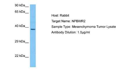 Western Blot: GPR8 Antibody [NBP2-86660]