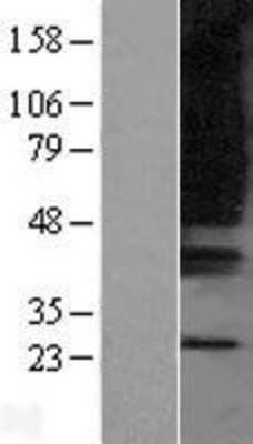 Western Blot: OXGR1/GPR80/P2Y15 Overexpression Lysate [NBL1-14021]