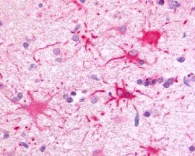 Immunohistochemistry-Paraffin: GPR81 Antibody - BSA Free [NLS2091]