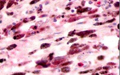 Immunohistochemistry-Paraffin: GPR81 Antibody - BSA Free [NLS2091]