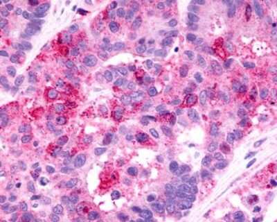 Immunohistochemistry-Paraffin: GPR81 Antibody - BSA Free [NLS2095]