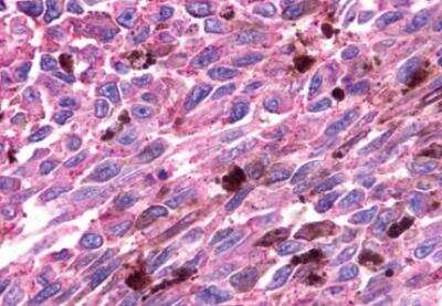 Immunohistochemistry-Paraffin: GPR81 Antibody - BSA Free [NLS2095]