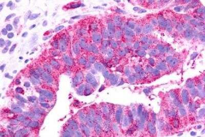 Immunohistochemistry-Paraffin: GPR81 Antibody - BSA Free [NLS2095]