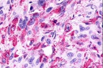Immunohistochemistry-Paraffin: GPR81 Antibody - BSA Free [NLS2095]