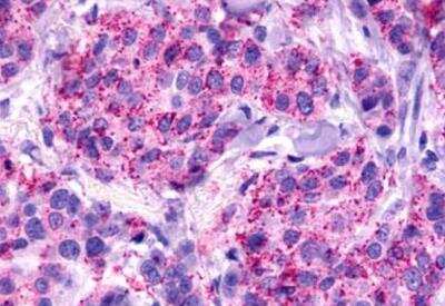 Immunohistochemistry-Paraffin: GPR81 Antibody - BSA Free [NLS2095]