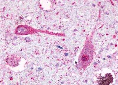 Immunohistochemistry-Paraffin: GPR81 Antibody - BSA Free [NLS2095]