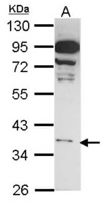 Western Blot: GPR81 Antibody [NBP1-32128]