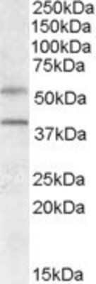 Western Blot: GPR81 Antibody [NBP1-51956]