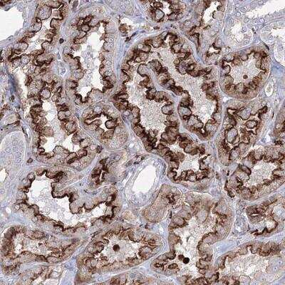 Immunohistochemistry: GPR82 Antibody [NBP1-86298]