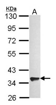 Western Blot: GPR82 Antibody [NBP2-16725]