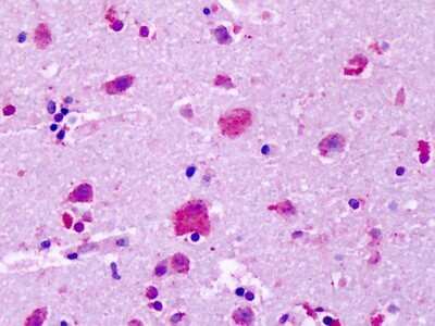 Immunohistochemistry-Paraffin: GPR83 Antibody - BSA Free [NLS4954]