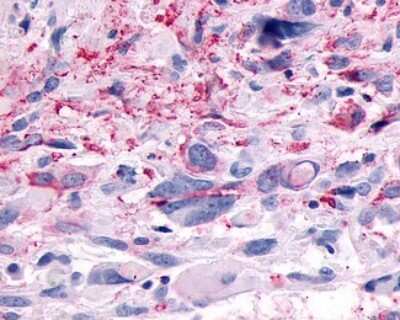 Immunohistochemistry-Paraffin: GPR83 Antibody - BSA Free [NLS4957]