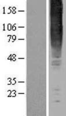 Western Blot: GPR83 Overexpression Lysate [NBL1-11296]