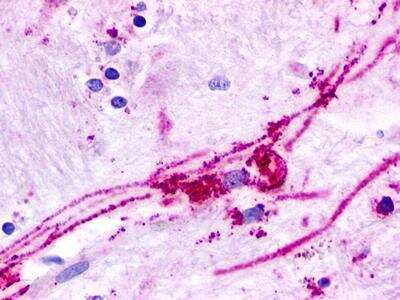 Immunohistochemistry-Paraffin: GPR84 Antibody - BSA Free [NLS343]