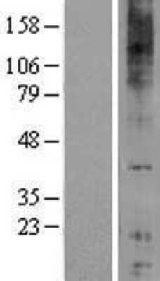 Western Blot: GPR84 Overexpression Lysate [NBL1-11297]