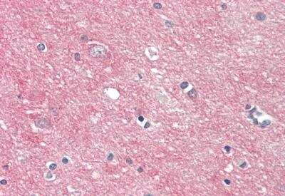 Immunohistochemistry-Paraffin: GPR85 Antibody [NBP2-82242]