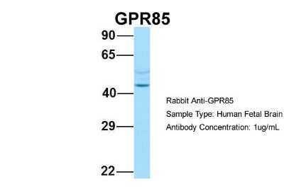 Western Blot: GPR85 Antibody [NBP2-82242]