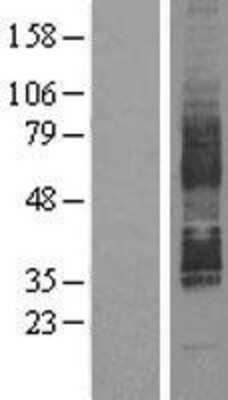 Western Blot: GPR85 Overexpression Lysate [NBL1-11298]