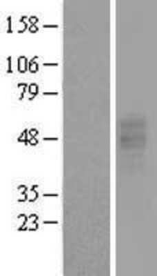 Western Blot: P2Y13/P2RY13/GPR86 Overexpression Lysate [NBL1-14041]