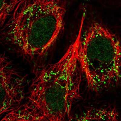 Immunocytochemistry/ Immunofluorescence: GPR87 Antibody [NBP2-56863]