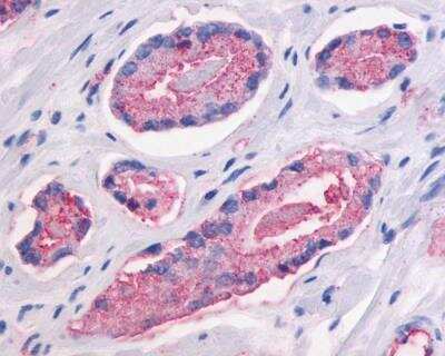 Immunohistochemistry: GPR87 Antibody - BSA Free [NLS1585]