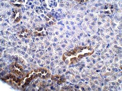 Immunohistochemistry-Paraffin: GPR87 Antibody [NBP3-12313]