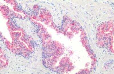 Immunohistochemistry-Paraffin: GPR87 Antibody - BSA Free [NLS1580]